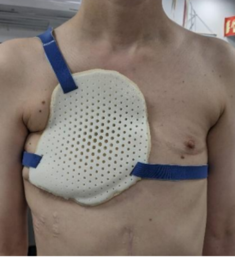 3D printed chest protector4